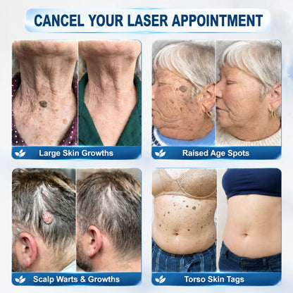 𝐏𝐡𝐚𝐫𝐦𝐚𝐜𝐢𝐬𝐭 𝐑𝐞𝐜𝐨𝐦𝐦𝐞𝐧𝐝𝐞𝐝🥇𝐏𝐮𝐫𝐞𝐥𝐨𝐫𝐚®7-𝐃𝐚𝐲 𝐒𝐤𝐢𝐧 𝐓𝐚𝐠 & 𝐒𝐩𝐨𝐭 𝐄𝐫𝐚𝐬𝐞𝐫 𝐂𝐫𝐞𝐚𝐦 🍀(Zero Pain, Zero 𝐒𝐜𝐚𝐫𝐬 Formula)