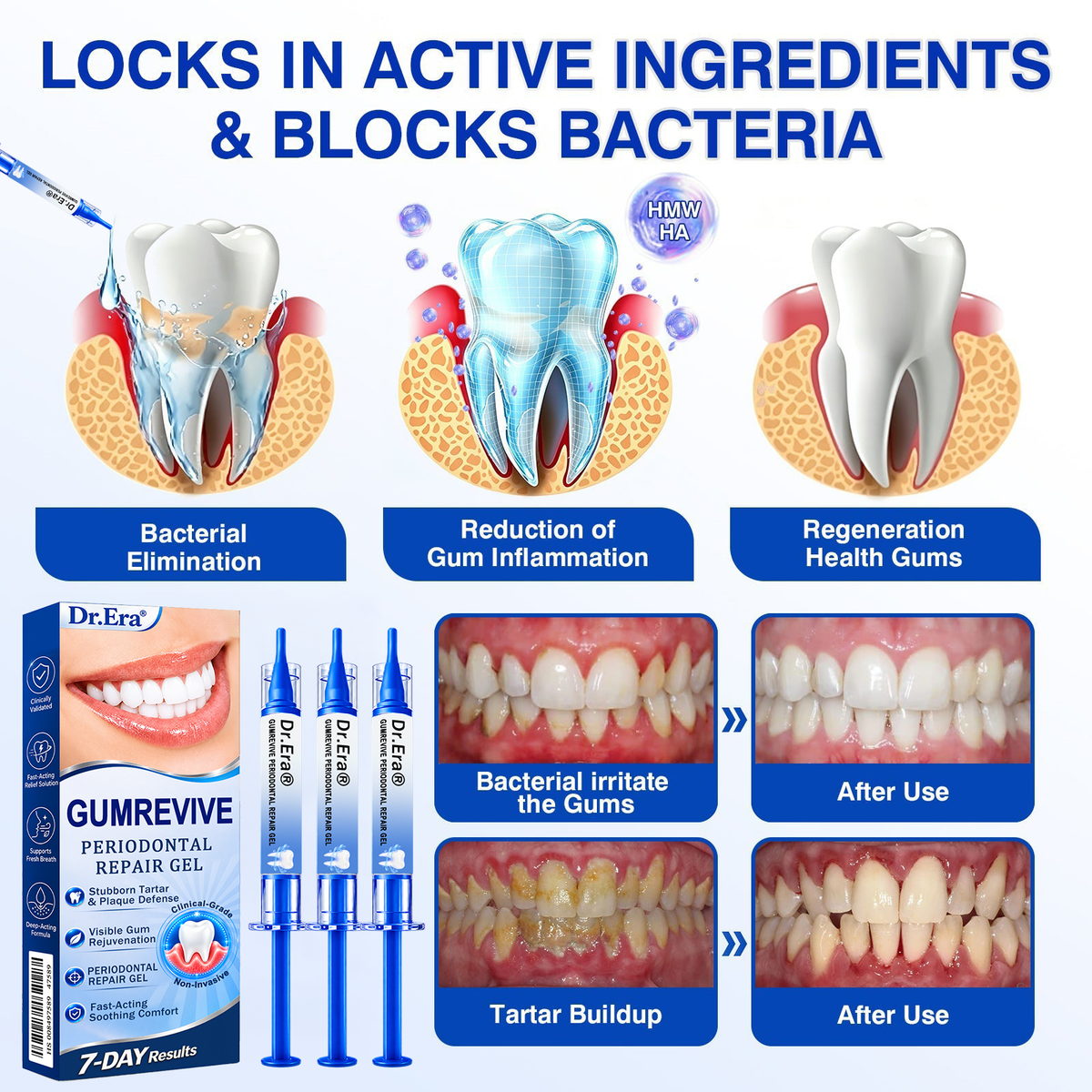 🇺🇸𝐎𝐟𝐟𝐢𝐜𝐢𝐚𝐥 𝐒𝐭𝐨𝐫𝐞 | 🧑‍⚕️🧑‍⚕️𝐃𝐫.𝐄𝐫𝐚® 𝐆𝐮𝐦𝐑𝐞𝐯𝐢𝐯𝐞 𝐏𝐞𝐫𝐢𝐨𝐝𝐨𝐧𝐭𝐚𝐥 𝐑𝐞𝐩𝐚𝐢𝐫 𝐆𝐞𝐥 — 𝐓𝐚𝐫𝐠𝐞𝐭𝐞𝐝 𝐆𝐮𝐦𝐥𝐢𝐧𝐞 𝐒𝐮𝐩𝐩𝐨𝐫𝐭 𝐟𝐨𝐫 𝐏𝐥𝐚𝐪𝐮𝐞, 𝐂𝐚𝐯𝐢𝐭𝐢𝐞𝐬, 𝐏𝐞𝐫𝐢𝐨𝐝𝐨𝐧𝐭𝐚𝐥 𝐂𝐨𝐧𝐜𝐞𝐫𝐧𝐬, 𝐁𝐚𝐝 𝐁𝐫𝐞𝐚𝐭𝐡 & 𝐖𝐞𝐚𝐤 𝐓𝐞𝐞𝐭𝐡 | 𝐏𝐫𝐞𝐜𝐢𝐬𝐢𝐨𝐧 𝐋𝐞𝐚𝐯𝐞-𝐎𝐧 𝐎𝐫𝐚𝐥 𝐂𝐚𝐫𝐞 𝐅𝐨𝐫𝐦𝐮𝐥𝐚