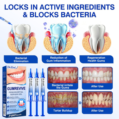 🇺🇸𝐎𝐟𝐟𝐢𝐜𝐢𝐚𝐥 𝐒𝐭𝐨𝐫𝐞 | 🧑‍⚕️🧑‍⚕️𝐃𝐫.𝐄𝐫𝐚® 𝐆𝐮𝐦𝐑𝐞𝐯𝐢𝐯𝐞 𝐏𝐞𝐫𝐢𝐨𝐝𝐨𝐧𝐭𝐚𝐥 𝐑𝐞𝐩𝐚𝐢𝐫 𝐆𝐞𝐥 — 𝐓𝐚𝐫𝐠𝐞𝐭𝐞𝐝 𝐆𝐮𝐦𝐥𝐢𝐧𝐞 𝐒𝐮𝐩𝐩𝐨𝐫𝐭 𝐟𝐨𝐫 𝐏𝐥𝐚𝐪𝐮𝐞, 𝐂𝐚𝐯𝐢𝐭𝐢𝐞𝐬, 𝐏𝐞𝐫𝐢𝐨𝐝𝐨𝐧𝐭𝐚𝐥 𝐂𝐨𝐧𝐜𝐞𝐫𝐧𝐬, 𝐁𝐚𝐝 𝐁𝐫𝐞𝐚𝐭𝐡 & 𝐖𝐞𝐚𝐤 𝐓𝐞𝐞𝐭𝐡 | 𝐏𝐫𝐞𝐜𝐢𝐬𝐢𝐨𝐧 𝐋𝐞𝐚𝐯𝐞-𝐎𝐧 𝐎𝐫𝐚𝐥 𝐂𝐚𝐫𝐞 𝐅𝐨𝐫𝐦𝐮𝐥𝐚